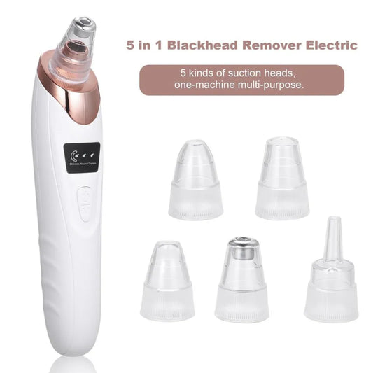5-in-1 Blackhead Remover