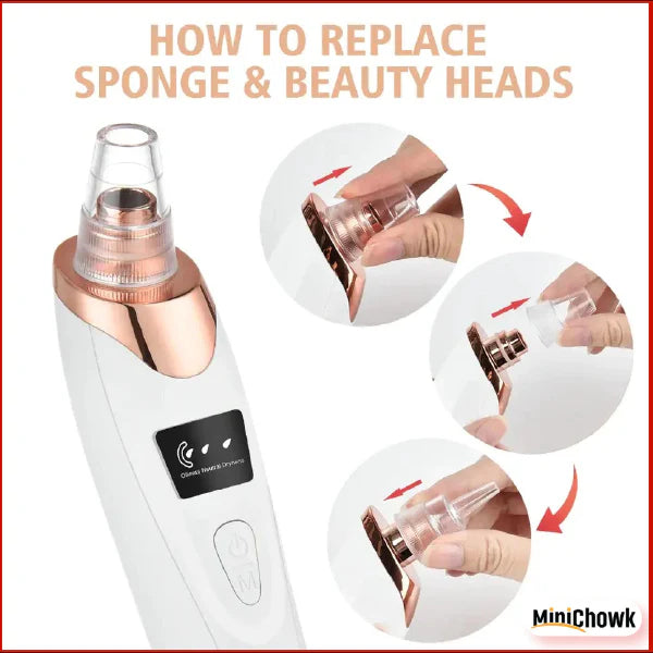 5-in-1 Blackhead Remover