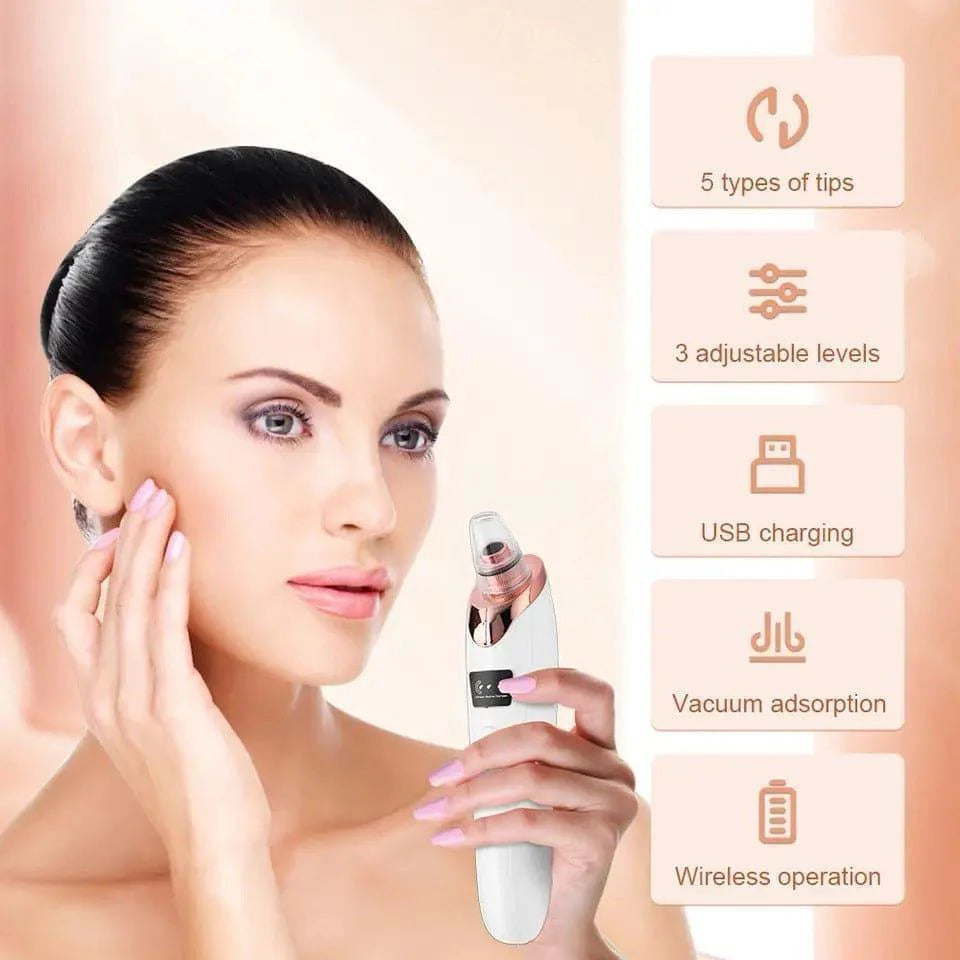 5-in-1 Blackhead Remover