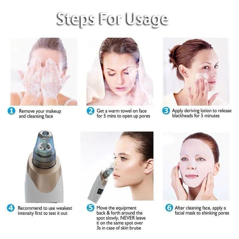 5-in-1 Blackhead Remover