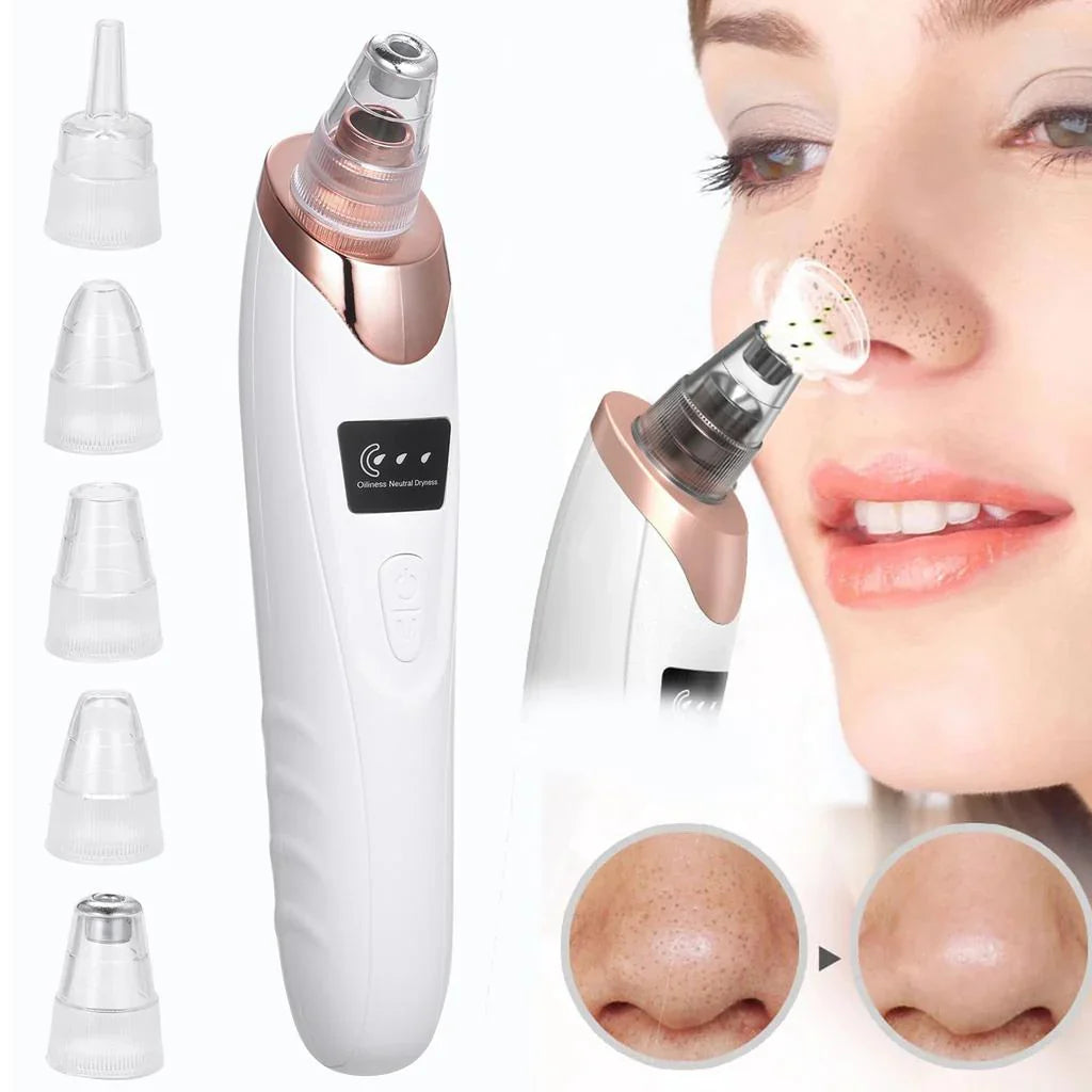 5-in-1 Blackhead Remover